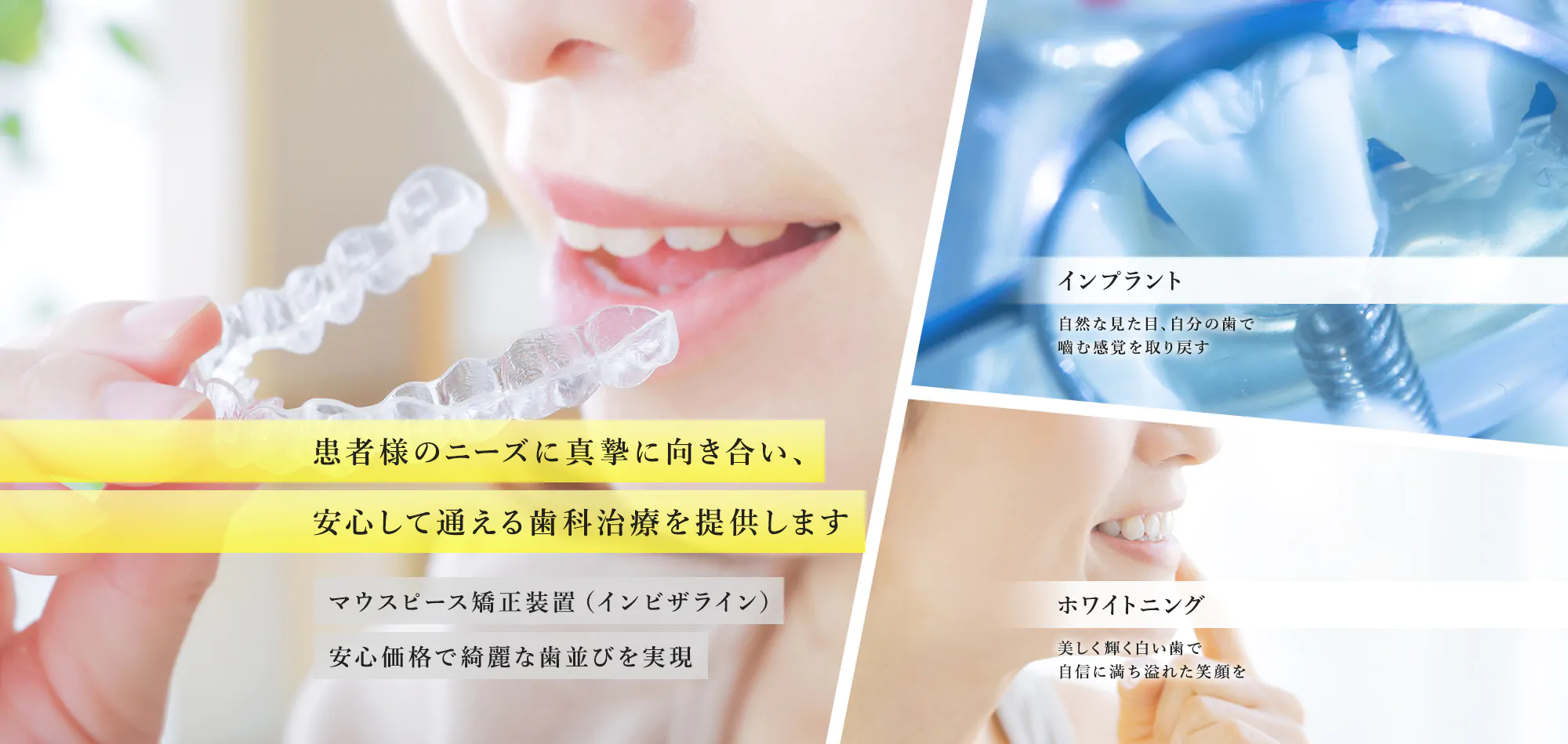 心からリラックスできる空間を…思いやりの心を持って、皆様と接することを心掛けている梅田の歯医者・歯科